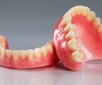 РЕМОНТ зубних протезів 1
